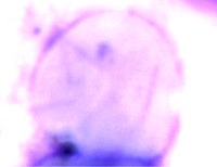Eritrócitos project thumbnail