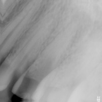 dheeraj dentistry 2 project thumbnail