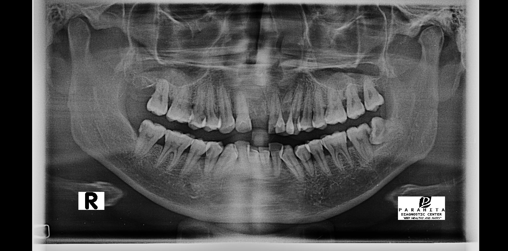 Nfd object detection dataset by mif