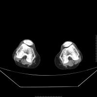 soft tissue project thumbnail