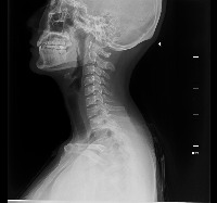 lateral classifier project thumbnail