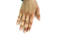 Skin Analyzer Classification project thumbnail