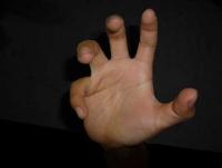 Finger Detection project thumbnail