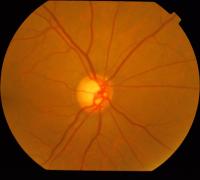 Optic-Disc-Train project thumbnail