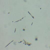 MicroAlgae project thumbnail