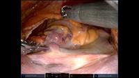 project-mitral project thumbnail
