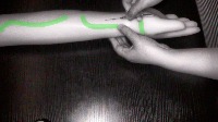 vein_10 project thumbnail