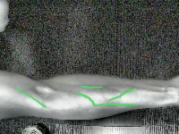 vein_2 project thumbnail