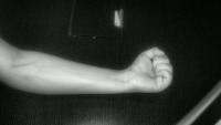 vein_clahe_20260714 project thumbnail