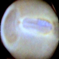 Intact project thumbnail