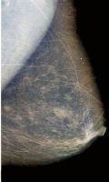 BreastTissueDetect project thumbnail