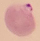 malariaclassification project thumbnail