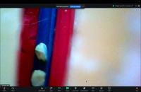 DVT surgery model project thumbnail