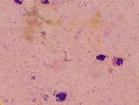 malaria_data project thumbnail