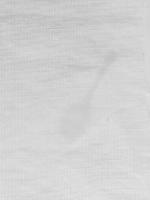 Fabric Defect Detection new project thumbnail