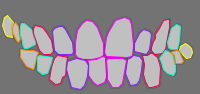 Annotation Visualization