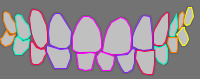 Annotation Visualization