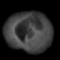 sample-hazelnut-xray project thumbnail