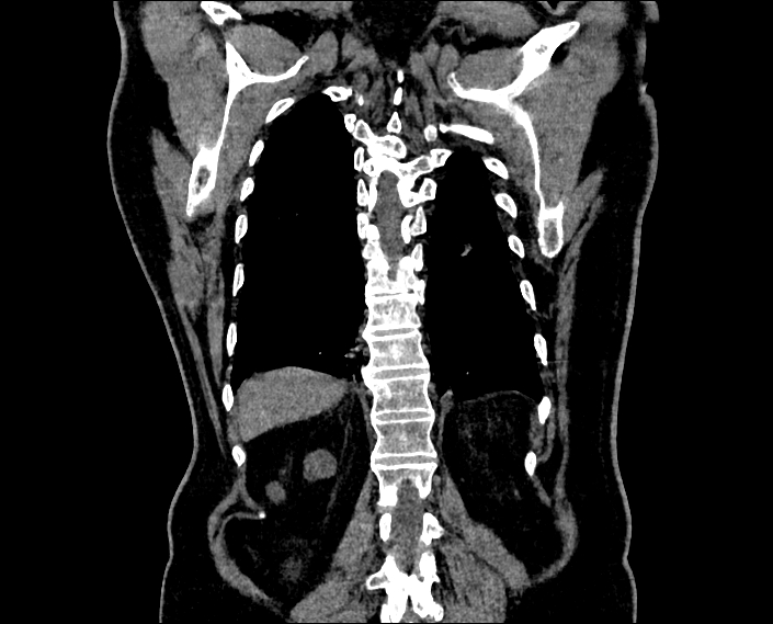 knn Classification Model by kidney