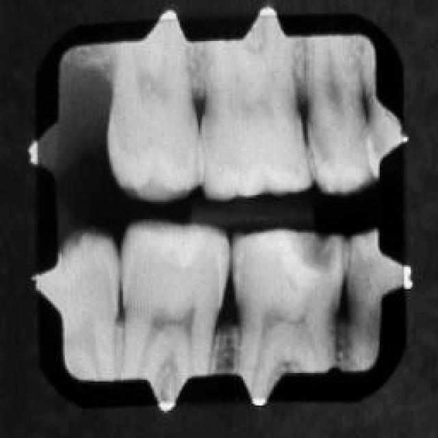 dental-training-app-roboflow-universe