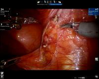 RARP_CASE004 project thumbnail