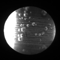 Bubbles Detect project thumbnail