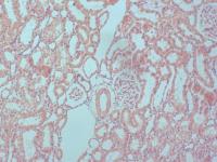 GlomerulusDetection project thumbnail
