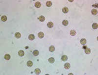 Urchin Eggs project thumbnail
