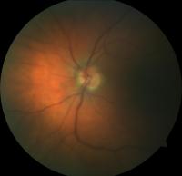 Eye 0 project thumbnail