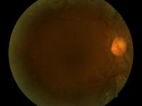 Eyes 4 project thumbnail