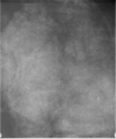 Xray Trash Detection project thumbnail