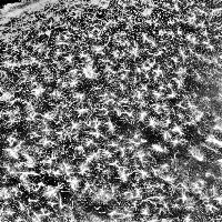 ALS_train1 project thumbnail