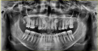 xray import project thumbnail