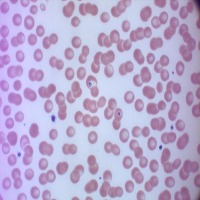 Segment Cells project thumbnail