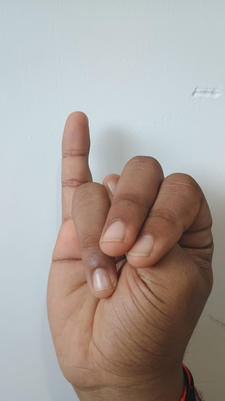 Tana Tana Tsfi6 Roboflow Universe