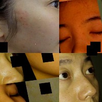 Updated-Datasetw/comedone project thumbnail