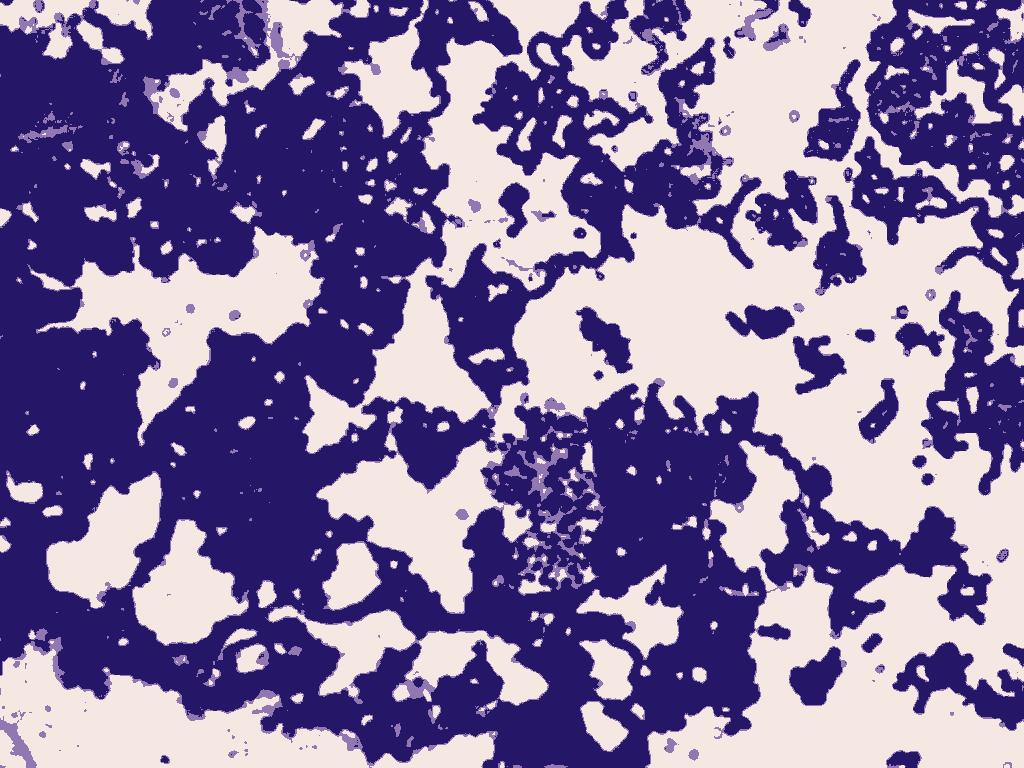 Cell Cluster Detect Object Detection Model by Harito