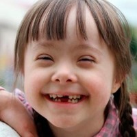down syndrome project thumbnail