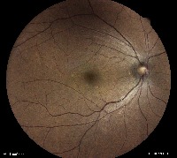 Dataset Image