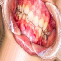 OralScan project thumbnail