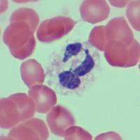 blood-cell-detection-test project thumbnail