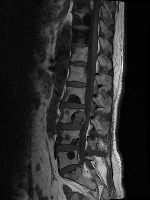 diease_classification project thumbnail