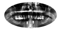 dentalai-i4clz-fsuo project thumbnail
