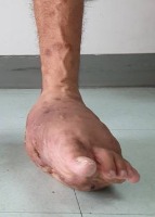 foot2 project thumbnail