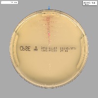 3ClassBacteria project thumbnail