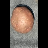 Detecting-Potato project thumbnail