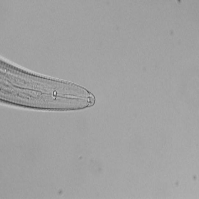 Nematodes Object Detection Dataset and Pre-Trained Model by Parasites