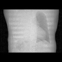 second_hospital_data project thumbnail