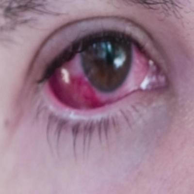 eye condision Classification Dataset by kyudi