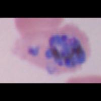Malaria Segmentation project thumbnail